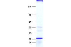 Validation with Western Blot (DUSP10 Protein (His tag))