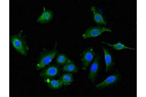 Immunofluorescent analysis of A549 cells using ABIN7149934 at dilution of 1:100 and Alexa Fluor 488-congugated AffiniPure Goat Anti-Rabbit IgG(H+L) (DPYSL4 antibody  (AA 280-560))