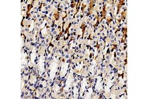 Immunohistochemistry of paraffin embedded rat stomach using ANXA3 (ABIN7073065) at dilution of 1: 300 (400x lens) (Annexin A3 antibody)