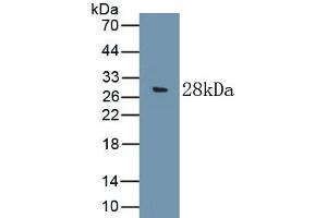 Detection of Recombinant C9, Rat using Polyclonal Antibody to Complement Component 9 (C9)