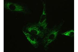 IF/ICC testing of human A549 cells with Ataxin-2 antibody at 2ug/ml. (Ataxin 2 antibody  (C-Term))