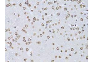 Immunohistochemistry (Paraffin-embedded Sections) (IHC (p)) image for anti-Lamin B2 (LMNB2) (AA 341-620) antibody (ABIN6143268)