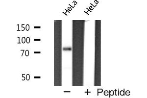 Western blot analysis of FOXP2 expression in HeLa cells