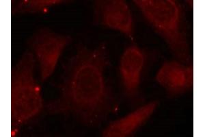 Immunofluorescence staining of methanol-fixed Hela cells using Merlin(Phospho-Ser518) Antibody. (Merlin antibody  (pSer518))