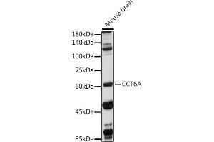 Western blot analysis of extracts of Mouse brain, using CCT6A antibody (ABIN1679063, ABIN3017847, ABIN3017849 and ABIN6220290) at 1:1000 dilution. (CCT6A antibody  (AA 80-250))