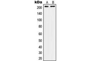 Western blot analysis of CD104 expression in A431 (A), SW480 (B) whole cell lysates. (Integrin beta 4 antibody  (C-Term))
