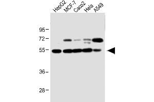 All lanes : Anti-CLU Antibody (N-term) at 1:1000 dilution Lane 1: HepG2 whole cell lysate Lane 2: MCF-7 whole cell lysate Lane 3: Caco2 whole cell lysate Lane 4: Hela whole cell lysate Lane 5: A549 whole cell lysate Lysates/proteins at 20 μg per lane. (Clusterin antibody  (N-Term))