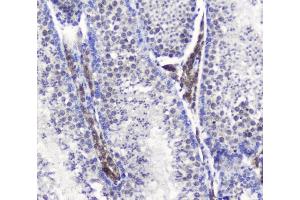 IHC analysis of SMC6L1 using anti-SMC6L1 antibody (ABIN5693133). (SMC6 antibody  (AA 205-443))