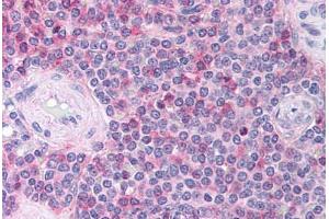 Human Spleen (formalin-fixed, paraffin-embedded) stained with CCL18 antibody ABIN214734 at 10 ug/ml followed by biotinylated goat anti-rabbit IgG secondary antibody ABIN481713, alkaline phosphatase-streptavidin and chromogen. (CCL18 antibody  (C-Term))