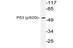 Western blot (WB) analysis of p-P53 antibody in extracts from COS7 cells. (p53 antibody  (pSer20))