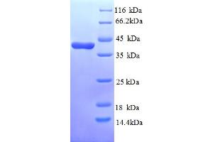 SDS-PAGE (SDS) image for Glycine Receptor, alpha 2 (GLRa2) (AA 27-143), (Extracellular) protein (GST tag) (ABIN5709561)