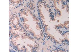 Used in DAB staining on fromalin fixed paraffin- embedded Kidney tissue (SCUBE3 antibody  (AA 807-993))