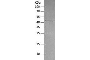 TBCEL Protein (AA 1-424) (His tag)