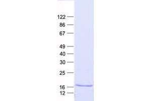 Histone H2B Type 1-C/E/F/G/I (LOC100407767) protein (His tag)