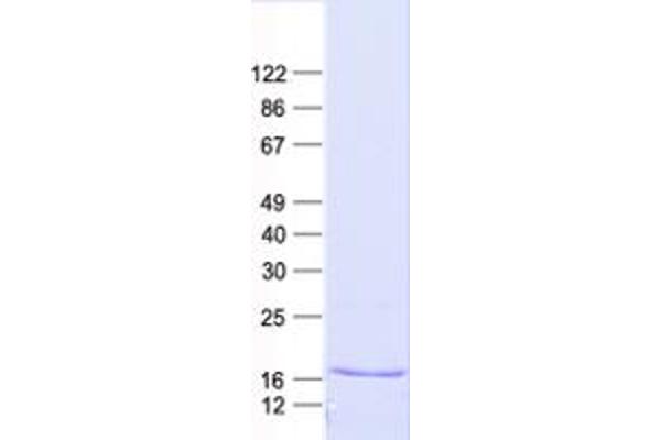 Histone H2B Type 1-C/E/F/G/I (LOC100407767) protein (His tag)