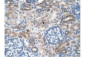 SLC14A1 antibody was used for immunohistochemistry at a concentration of 4-8 ug/ml. (SLC14A1 antibody  (C-Term))