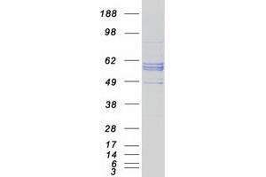 Validation with Western Blot (CYP27A1 Protein (Myc-DYKDDDDK Tag))
