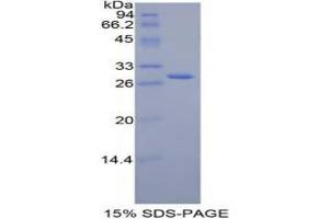 SDS-PAGE analysis of Mouse Jagged 2 Protein.