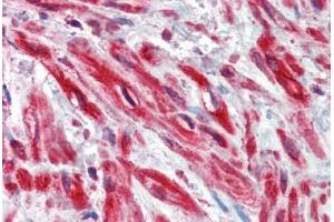 Human Prostate, stroma: Formalin-Fixed, Paraffin-Embedded (FFPE) (TRIM5 antibody)