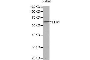 Western blot analysis of extracts of Jurkat cells tissue, using ELK1 antibody. (ELK1 antibody  (AA 90-250))