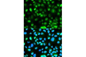 Immunofluorescence analysis of HeLa cells using ATXN3 antibody. (Ataxin 3 antibody  (AA 1-364))