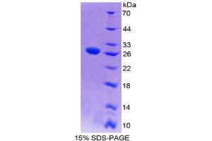 SDS-PAGE (SDS) image for Integrin, alpha X (Complement Component 3 Receptor 4 Subunit) (ITGAX) (AA 143-344) protein (His tag) (ABIN2125330) (CD11c Protein (AA 143-344) (His tag))