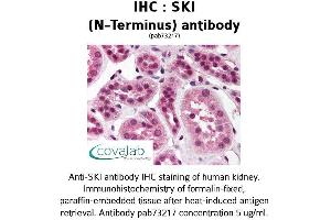 Image no. 2 for anti-SKI Proto-Oncogene (SKI) antibody (ABIN1739312) (SKI antibody)