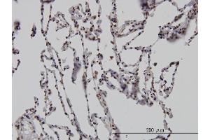 Immunoperoxidase of monoclonal antibody to DLX2 on formalin-fixed paraffin-embedded human lung. (DLX2 antibody  (AA 1-110))