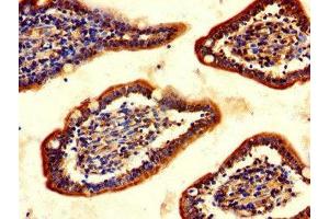 Immunohistochemistry of paraffin-embedded human small intestine tissue using ABIN7147620 at dilution of 1:100 (Choline Acetyltransferase antibody  (AA 354-592))