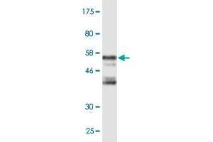 Western Blot detection against Immunogen (56. (LIM Domain Binding 3 Protein antibody  (AA 1-283))