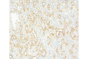 Immunohistochemistry (IHC) image for anti-CD36 (CD36) (AA 30-439) antibody (ABIN7449417) (Recombinant CD36 antibody  (AA 30-439))