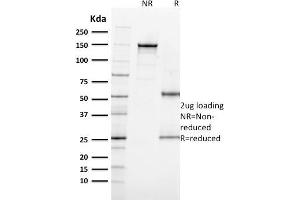 SDS-PAGE Analysis Purified MITF Mouse Monoclonal Antibody (MITF/915). (MITF antibody)