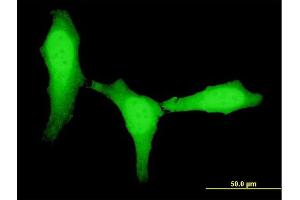 Immunofluorescence of monoclonal antibody to ZEB1 on HeLa cell. (ZEB1 antibody  (AA 801-900))