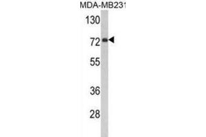 Western Blotting (WB) image for anti-Flavin Containing Monooxygenase 3 (FMO3) antibody (ABIN3002867)