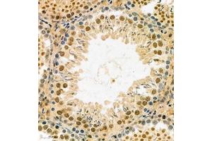 Immunohistochemistry analysis of paraffin embedded rat testis using MASTL (ABIN7074616) at dilution of 1: 2100 (MASTL antibody)