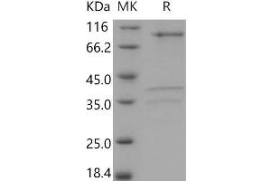 Western Blotting (WB) image for AMPK (A2/B2/G1) (Active) protein (ABIN7317040)