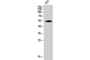 Western Blot analysis of 453 cells using Phospho-CaMKIIα/β/δ (T305) Polyclonal Antibody (CAMK2A/CAMK2B/CAMK2D (pThr305) antibody)