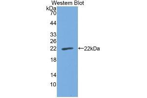 Western Blotting (WB) image for anti-Cell Division Cycle 25 (CDC25) (AA 376-524) antibody (ABIN1867137) (Cdc25 antibody  (AA 376-524))
