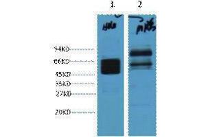 Western Blotting (WB) image for anti-Keratin 8 (KRT8) antibody (ABIN3181125) (KRT8 antibody)