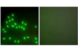 Immunofluorescence analysis of A549 cells, using Ku70/80 Antibody . (XRCC5 antibody  (C-Term))