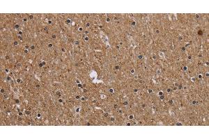 Immunohistochemistry of paraffin-embedded Human brain tissue using CMTM5 Polyclonal Antibody at dilution 1:40 (CMTM5 antibody)