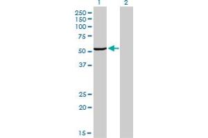 Western Blot analysis of MAK expression in transfected 293T cell line by MAK monoclonal antibody (M02), clone 4E9. (MAK antibody  (AA 358-457))