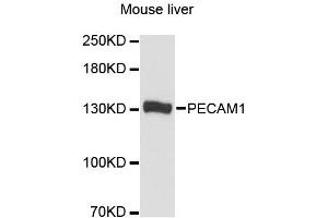 Western blot analysis of extracts of mouse liver, using PECAM1 antibody. (CD31 antibody)
