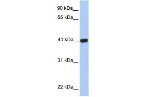 MGC29891 antibody used at 0. (GABPB2 antibody  (C-Term))