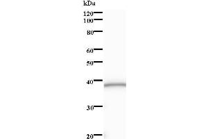 Western Blotting (WB) image for anti-SRY (Sex Determining Region Y)-Box 6 (SOX6) antibody (ABIN931254) (SOX6 antibody)