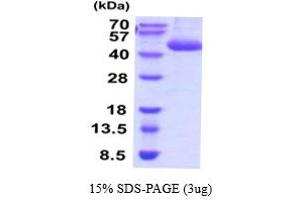 SDS-PAGE (SDS) image for Cathepsin E (CTSE) (AA 21-397) protein (His tag) (ABIN5854485) (Cathepsin E Protein (CTSE) (AA 21-397) (His tag))
