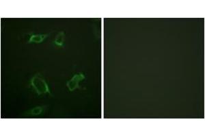 Immunofluorescence analysis of HepG2 cells, using PLD1 (Phospho-Ser561) Antibody. (PLD1 antibody  (pSer561))
