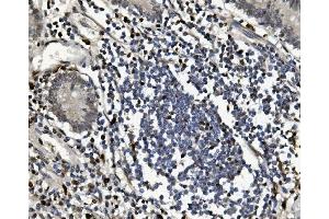 IHC analysis of SAMHD1 using anti-SAMHD1 antibody (ABIN7601516). (SAMHD1 antibody  (AA 37-626))