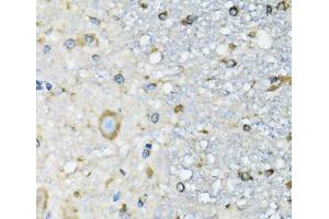 Immunohistochemistry (Paraffin-embedded Sections) (IHC (p)) image for anti-Aspartyl-tRNA Synthetase (DARS) antibody (ABIN7262443)