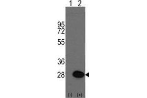 Western blot analysis of HSPB1(arrow) using rabbit polyclonal HSPB1 Antibody (HSP27 antibody  (Ser83))
